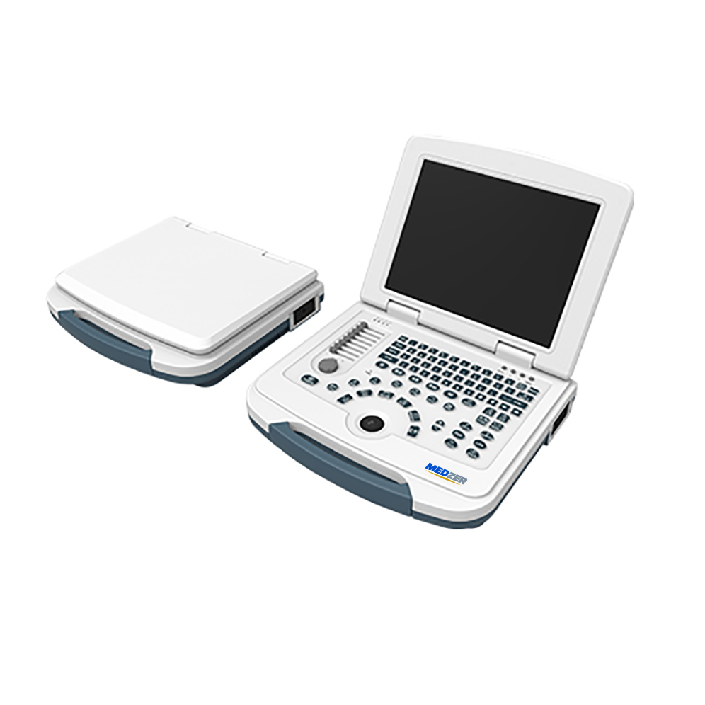 Laptop Ultrasound Scanner
