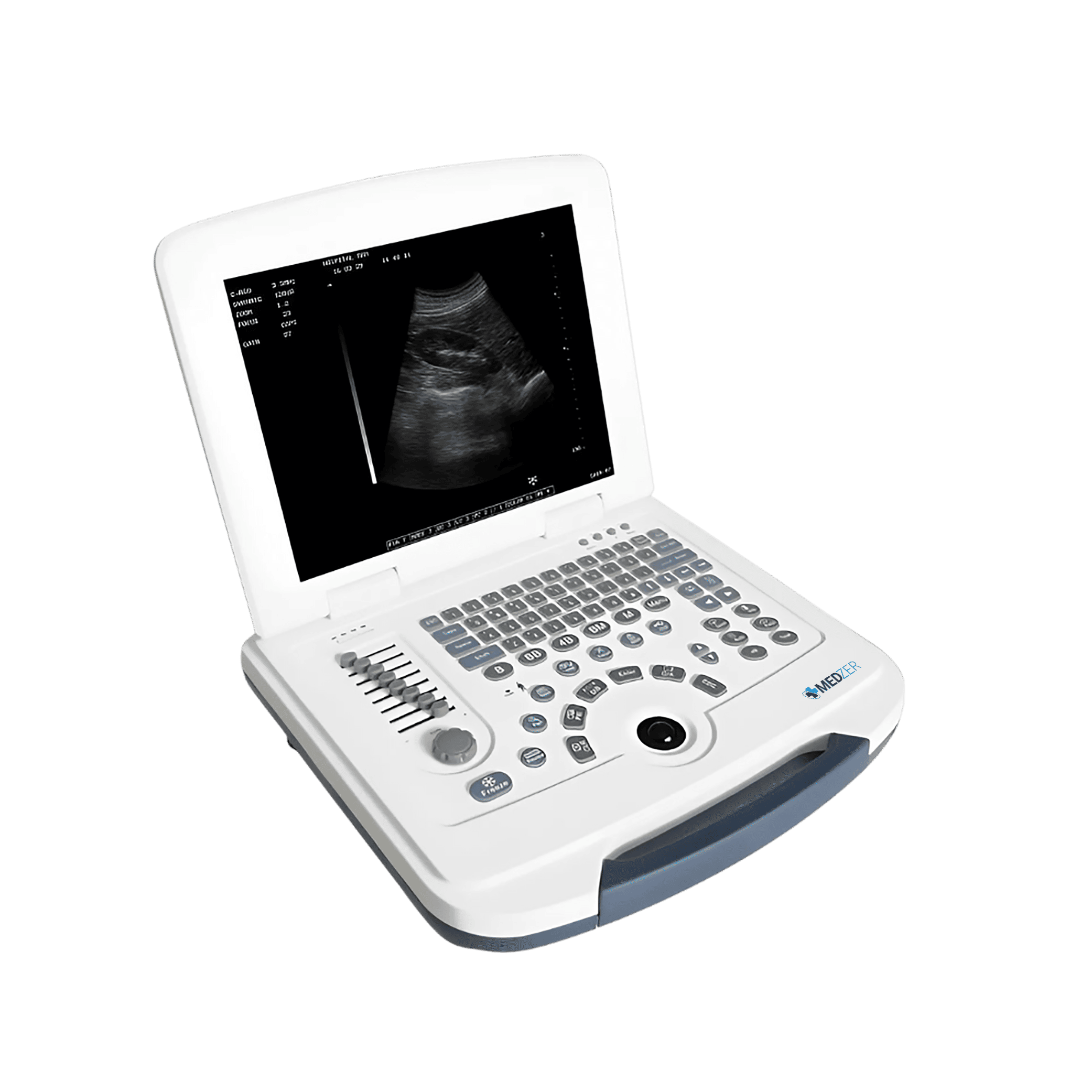 Laptop Ultrasound Scanner LUSG-1000D-3