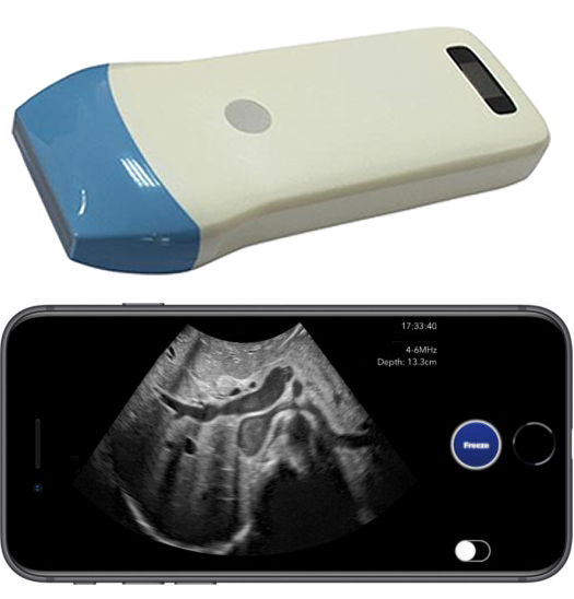 Pocket Ultrasound System PUSG-1000E