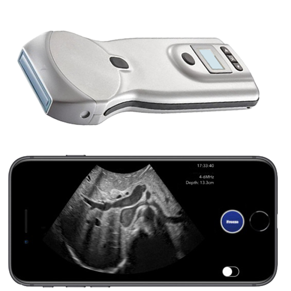 Pocket Ultrasound System PUSG-1000G